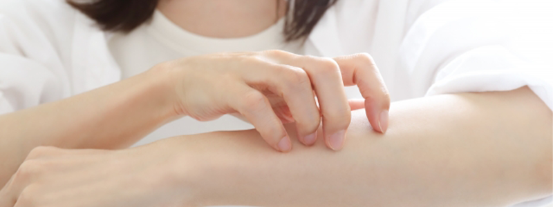 アトピーのイメージ