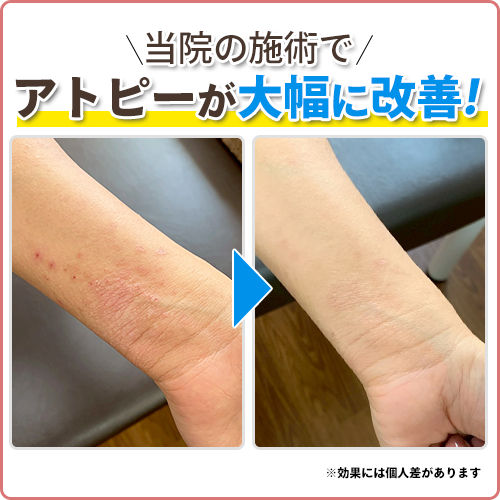 ビフォーアフター